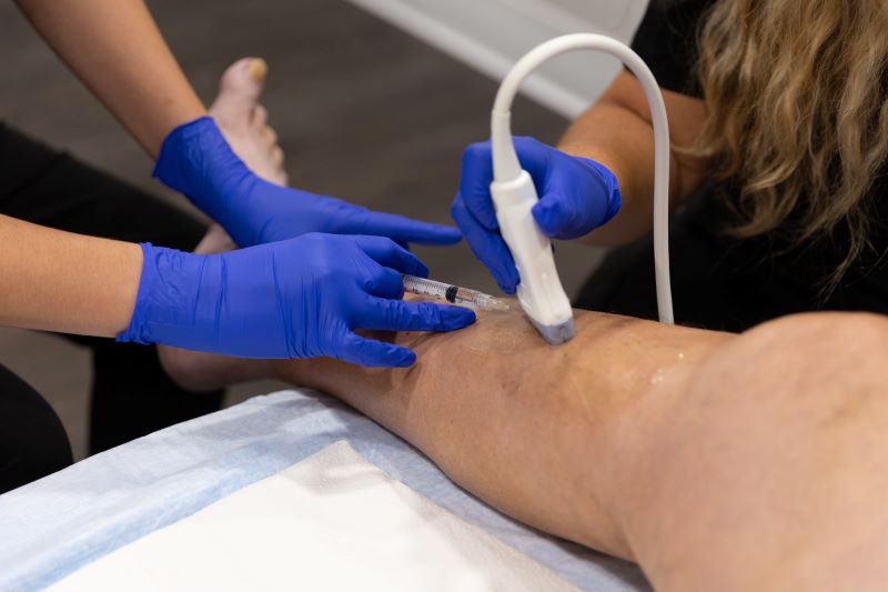 A patient receiving venous leg treatment from their Vein Doctor in North Port