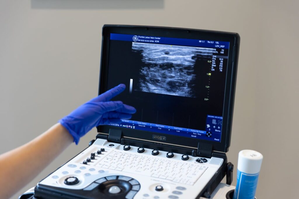 A vein doctor pointing at a computer screen's image to help a patient Improve Circulation in North Port